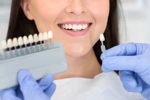 How Do Dental Veneers Actually Transform Your Smile In 3 Simple Steps?