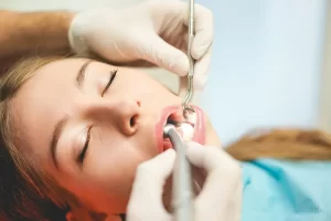 How Long Do Dental Fillings Actually Last? 7 Shocking Facts