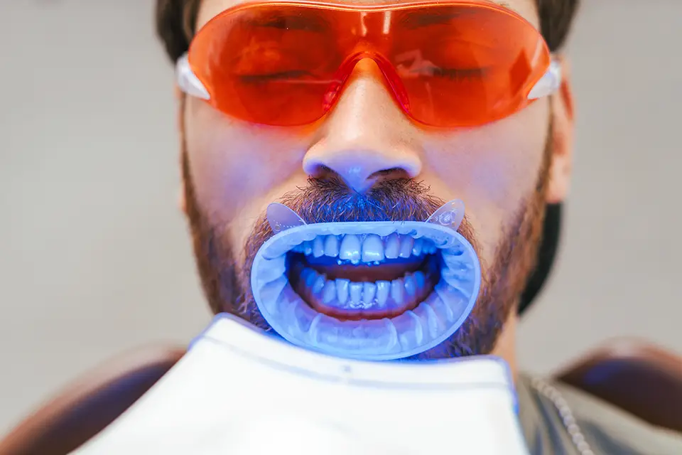 How Much Does Teeth Whitening Cost in Toronto: Add-Ons and "Hidden" Costs