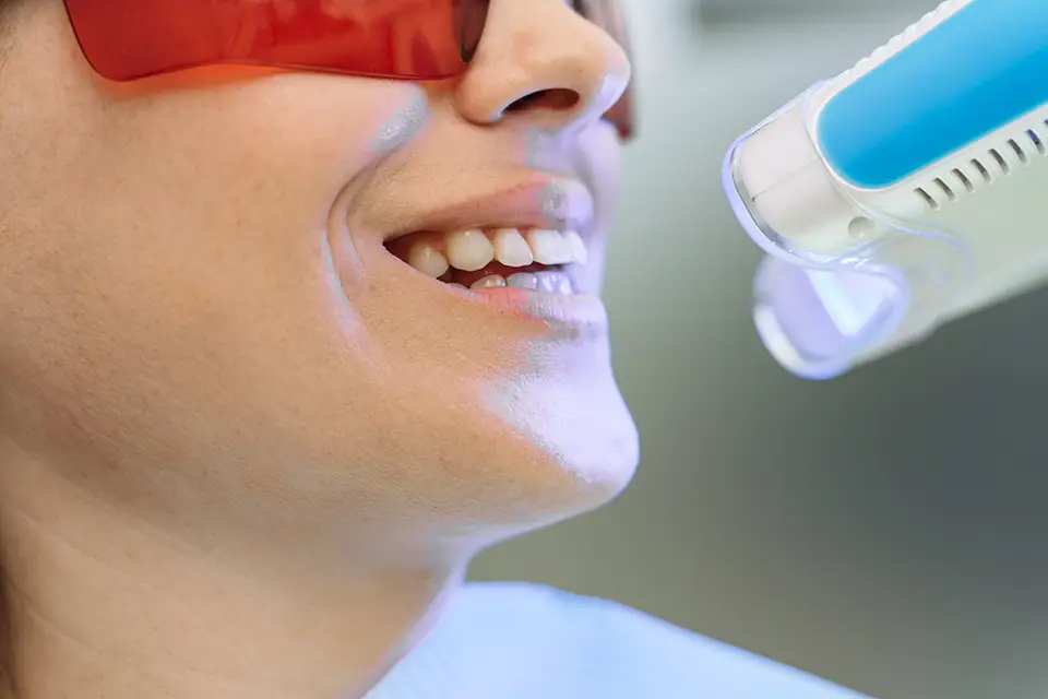 Zoom vs Laser Whitening Toronto: The Appointment Flow