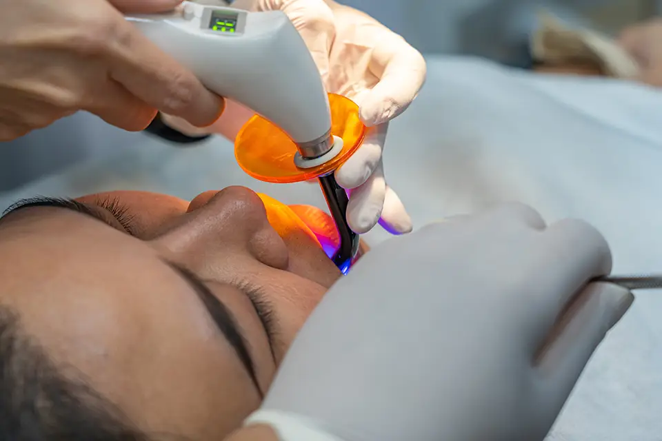 Zoom vs Laser Whitening Toronto: What's Technically Different?