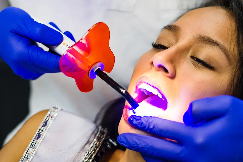 How Much Does Teeth Whitening Cost in Toronto: The Short Answer