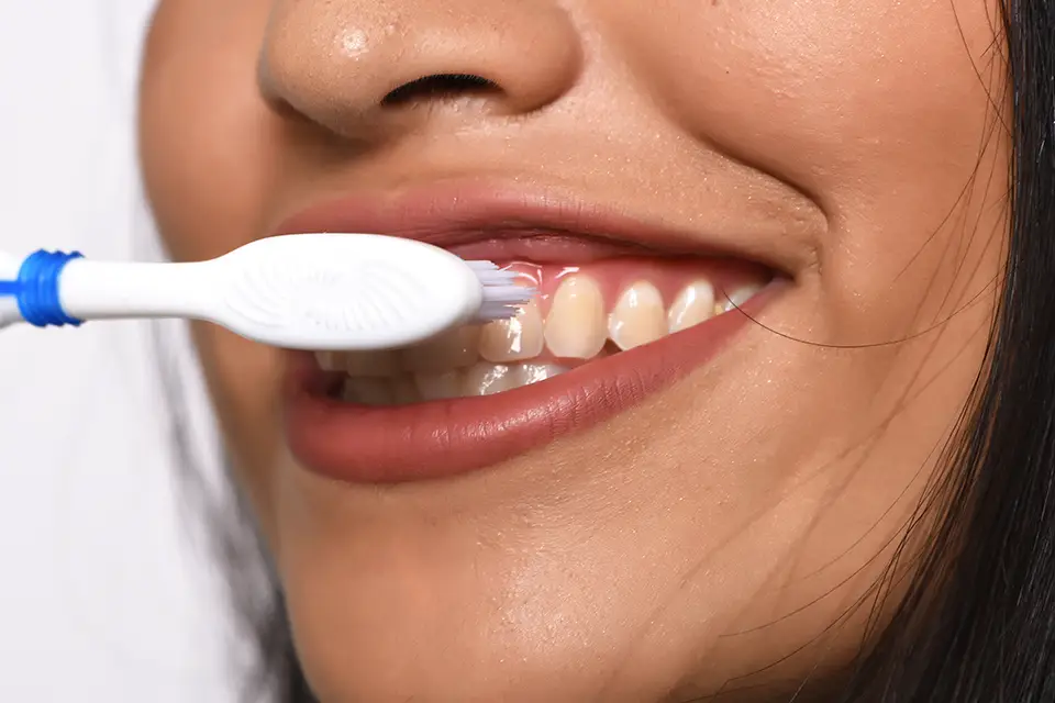 Affordable Teeth Whitening And Cleaning Toronto: What "Affordable" Should Mean Clinically