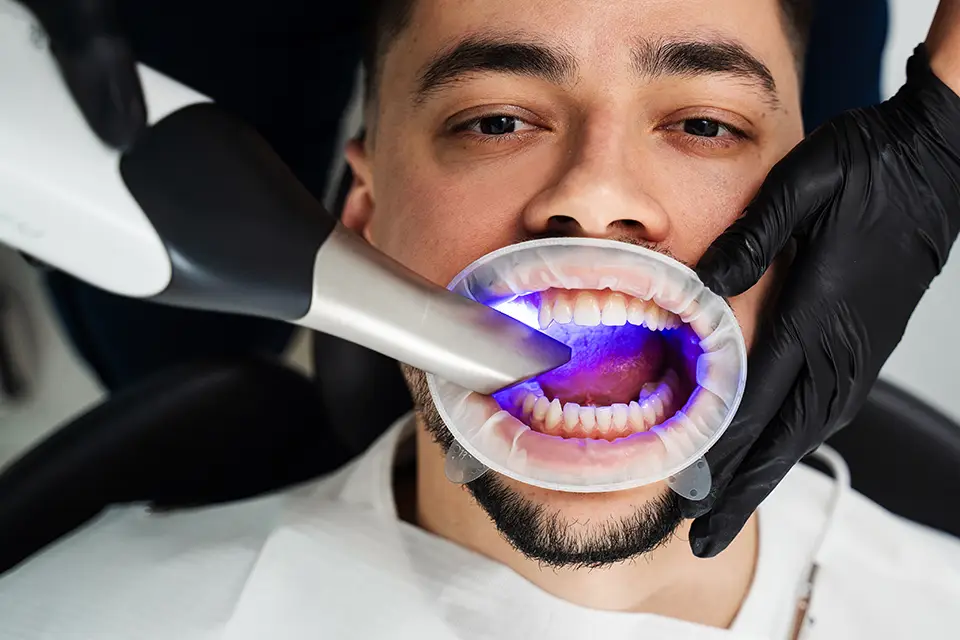 Affordable Teeth Whitening And Cleaning Toronto: A Practical Guide To A Brighter, Healthier Smile