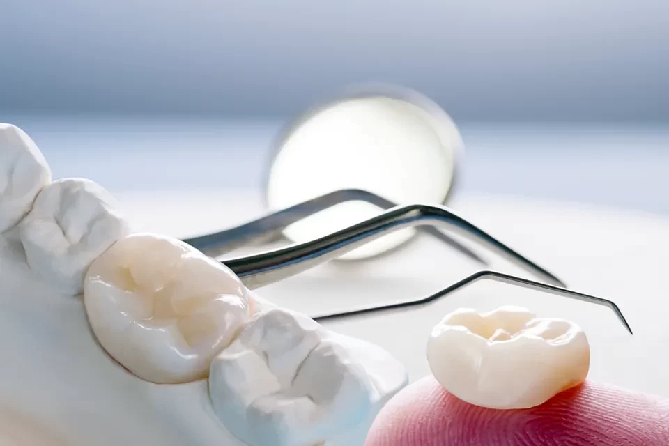 Dental Crowns Key Differences Between Porcelain vs. Ceramic Dental Crowns