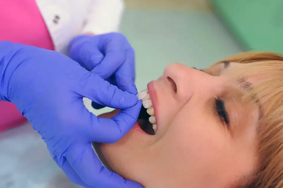 Dental Bonding Vs Veneers : What's Right for You?