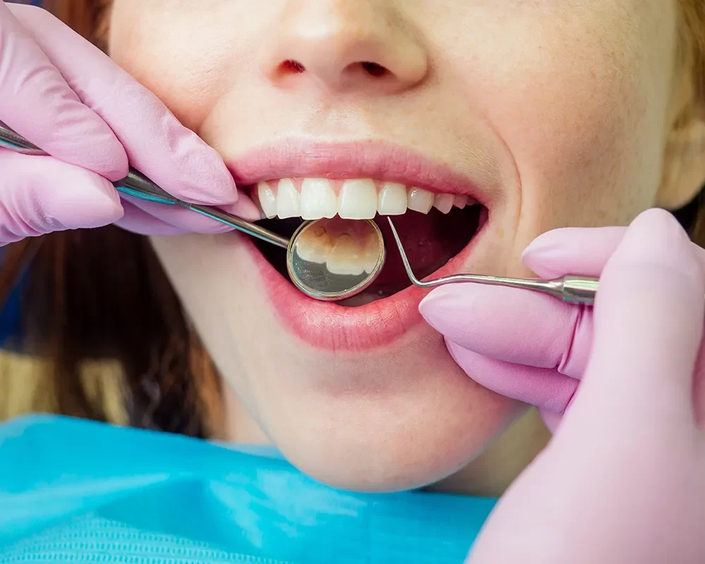 A woman smiling during a dental cleaning at Dental Cleaning in St. Clair