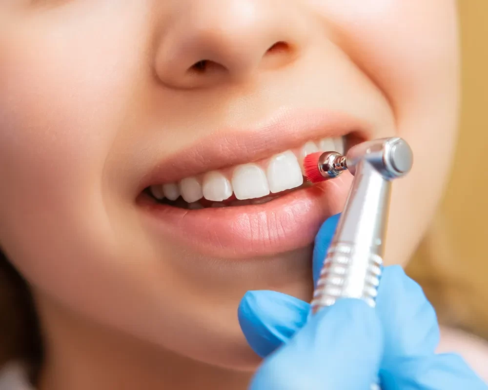 A woman receiving a dental check-up at Dental Cleaning in St. Clair