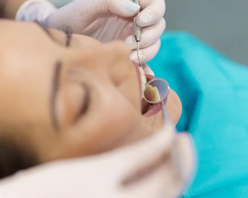 Affordable Tooth Checkups in St. Clair, Toronto