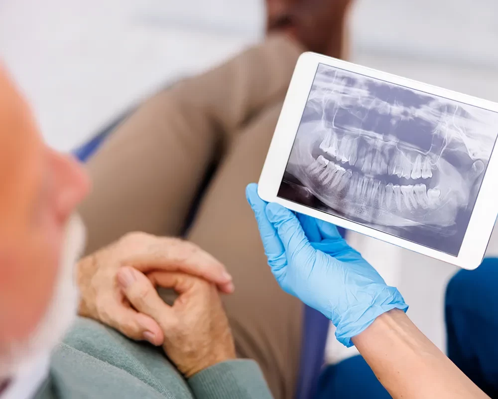 Affordable Tooth Checkups in St. Clair, Toronto