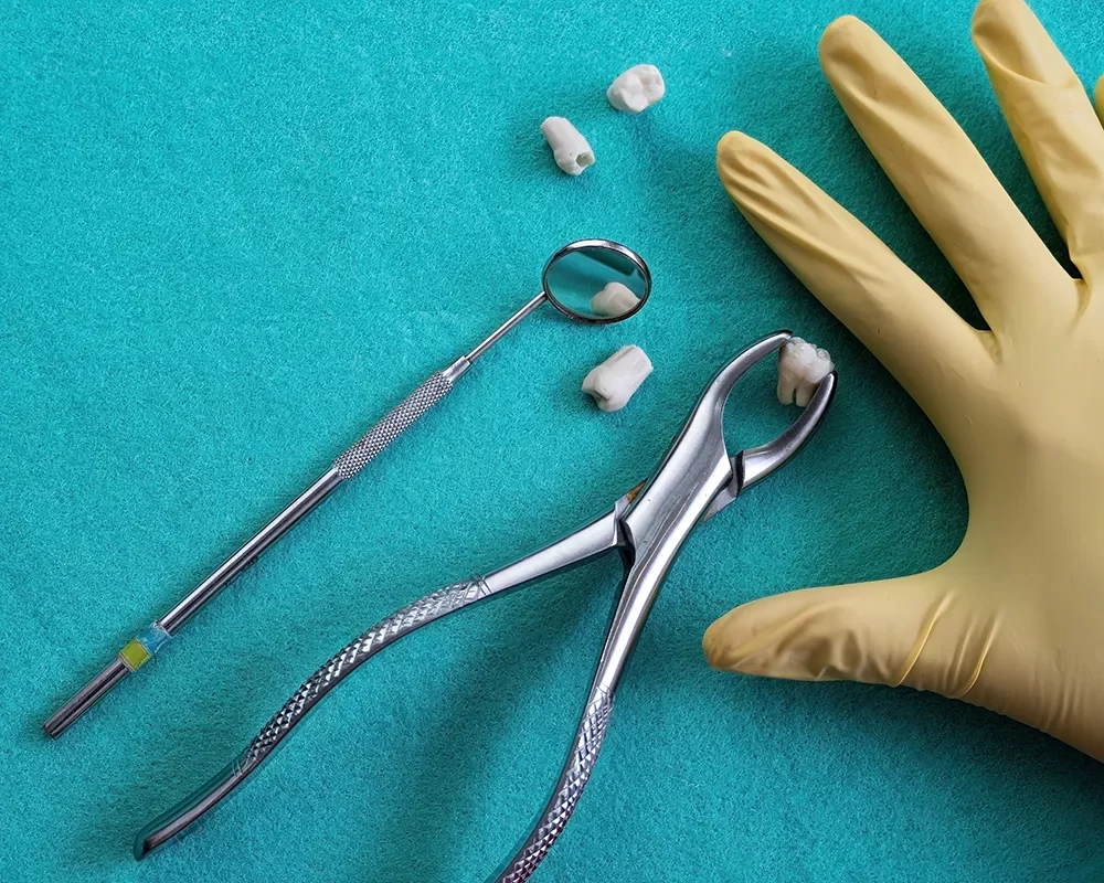 Best Tooth Removal in St. Clair, Toronto
