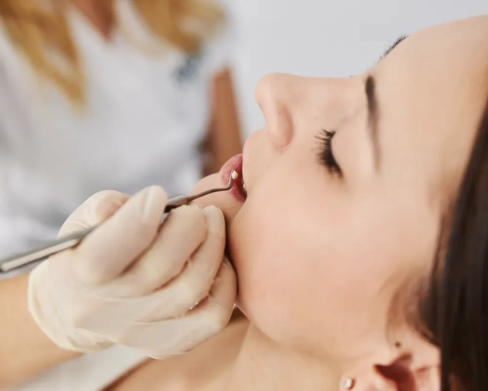 Affordable Dental Fillings in St. Clair, Toronto