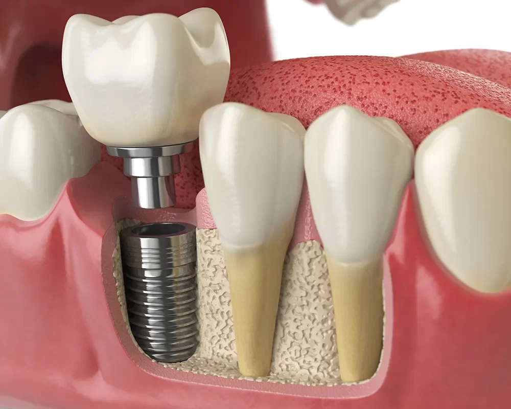 Affordable Dentistry in Toronto