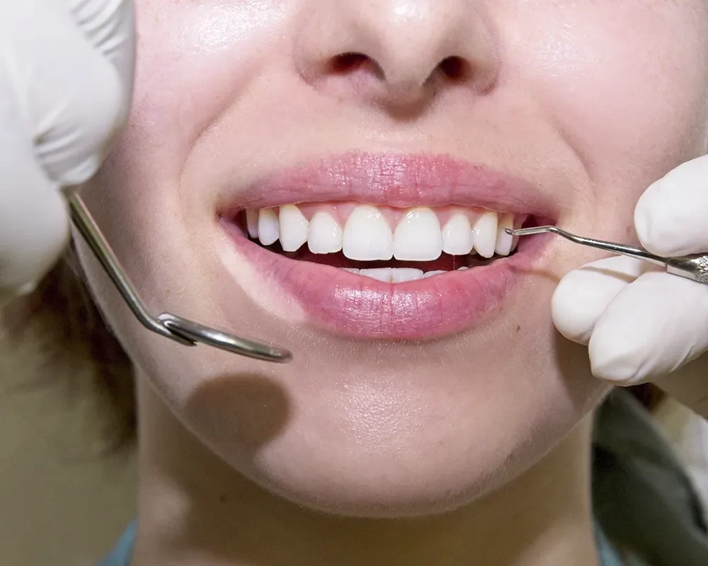 Best Dental Treatments in St. Clair, Toronto