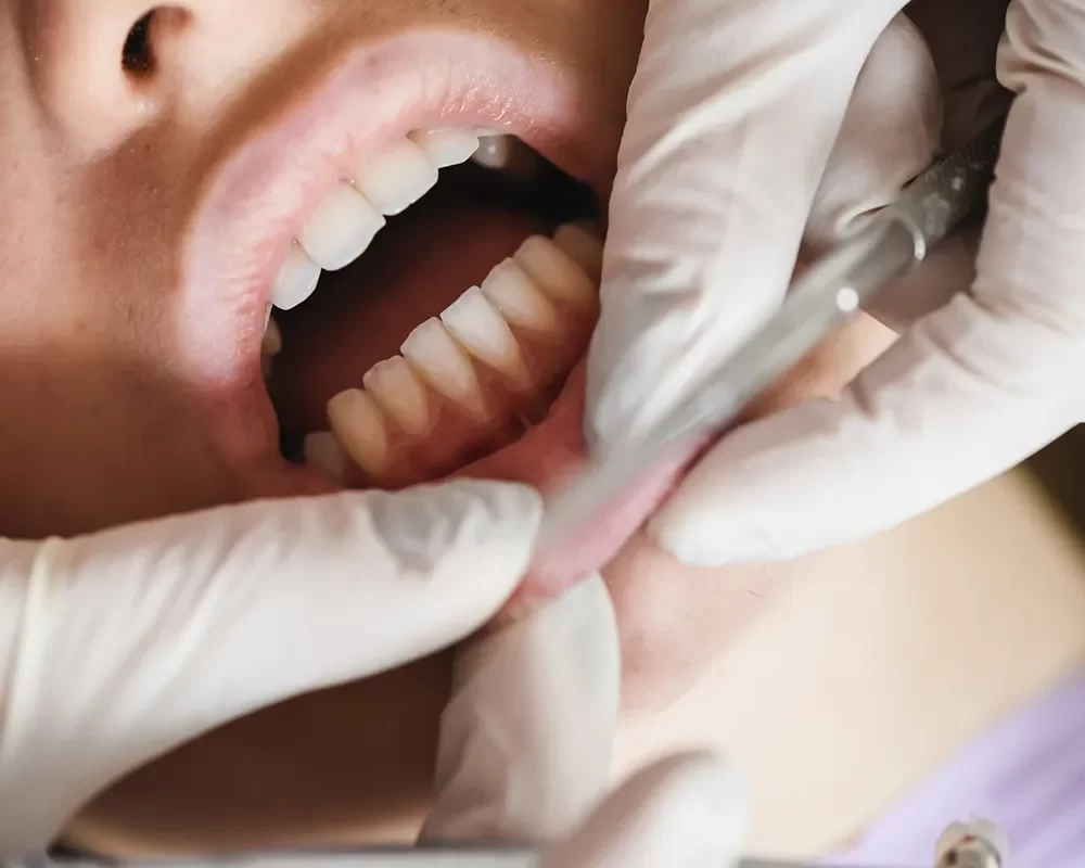 Dentist in Toronto