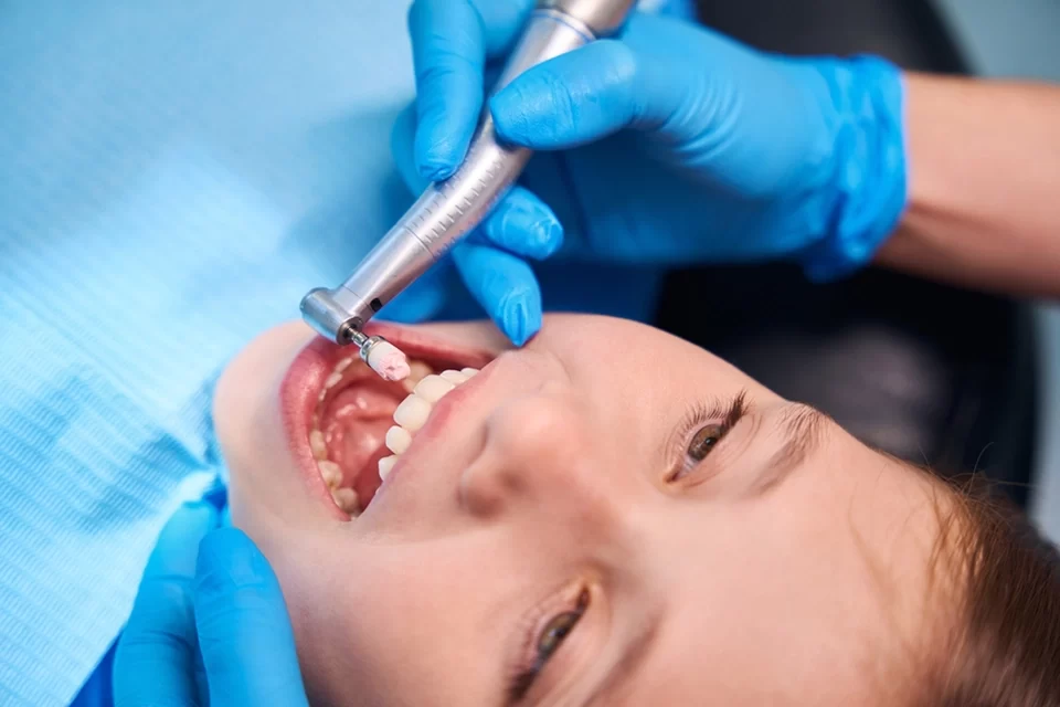 Dental fillings Dental fillings