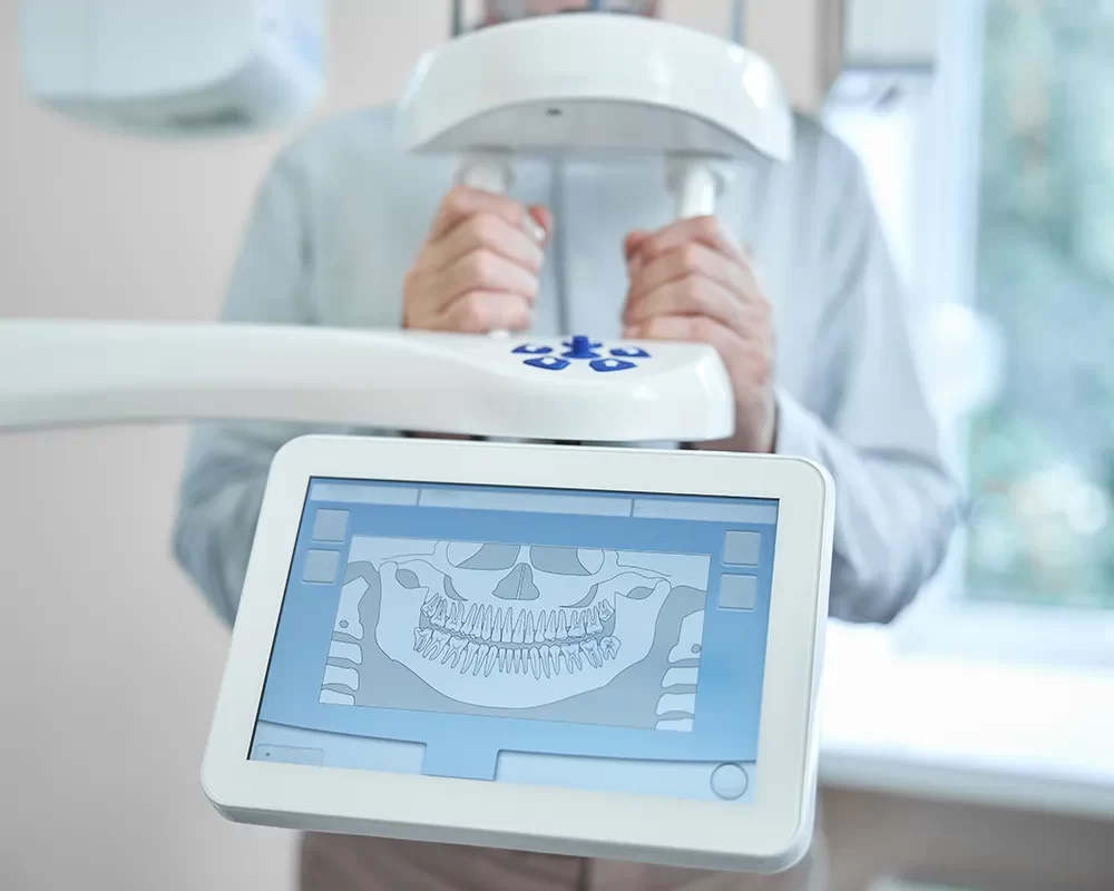 Affordable Digital X-Rays in St. Clair, Toronto