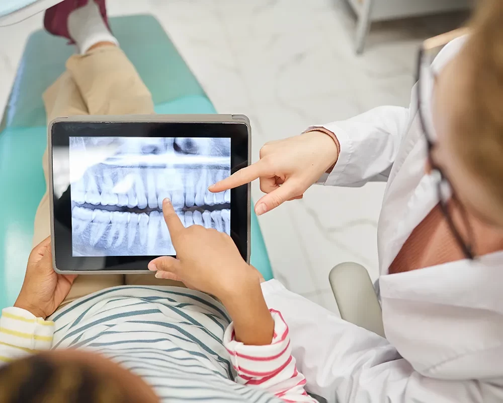 Digital Dental X-ray in St. Clair, Toronto