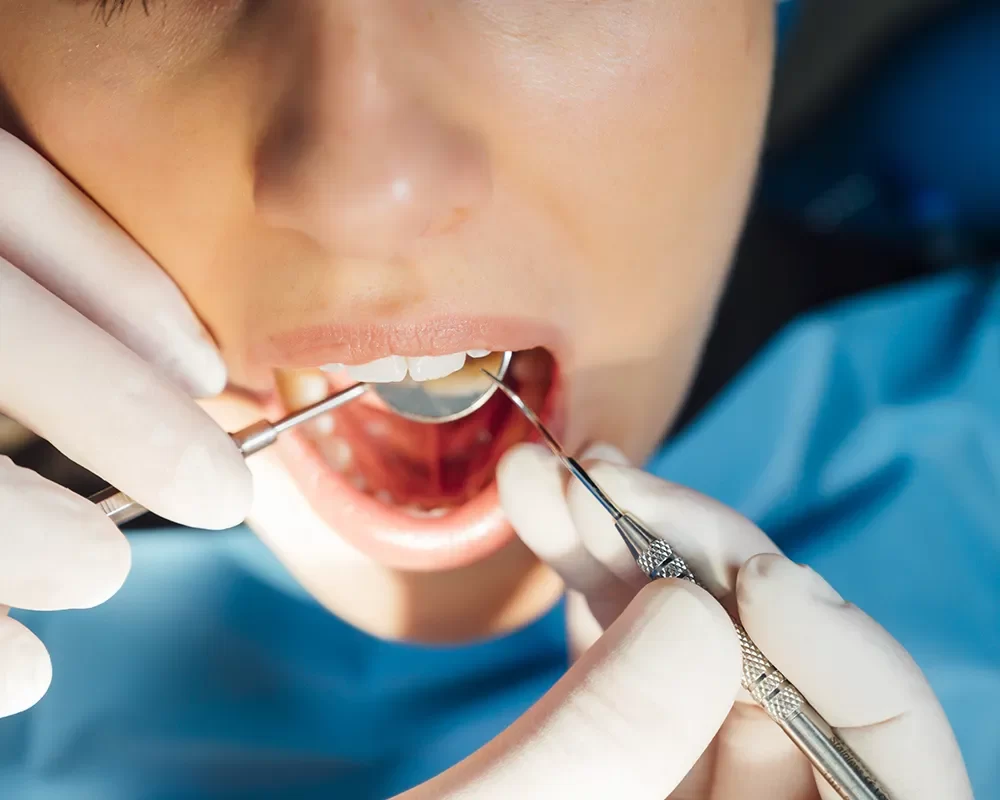 Best Dental Clinic in St. Clair, Toronto