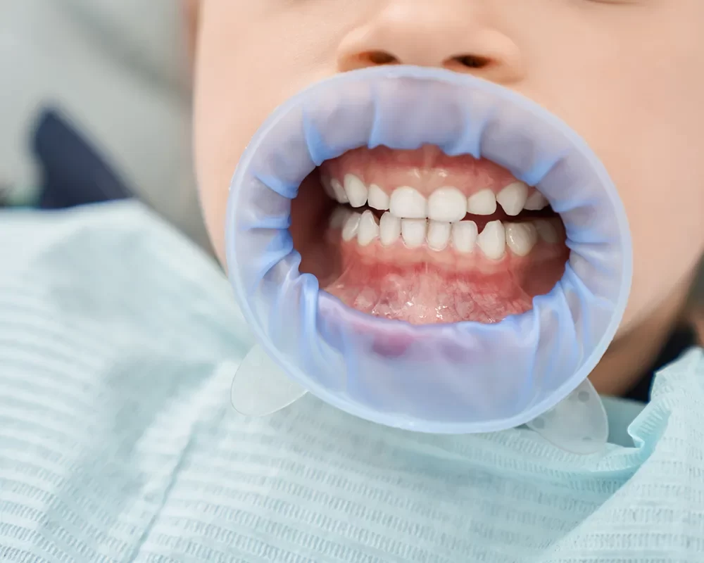 Perfect Kids Dentistry in St. Clair
