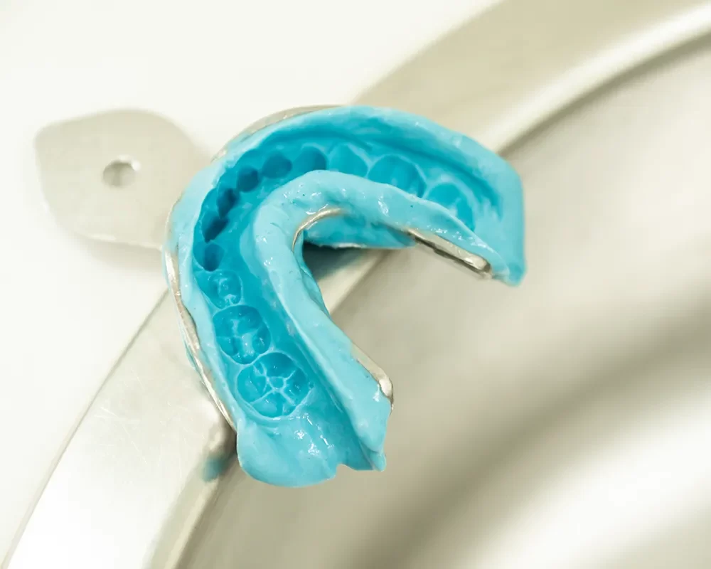 Perfect Mouth Guards in St. Clair, Toronto