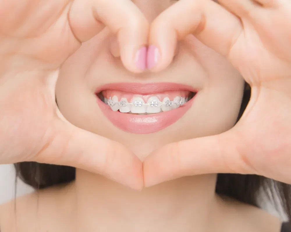 Orthodontics Best Orthodontics in Toronto