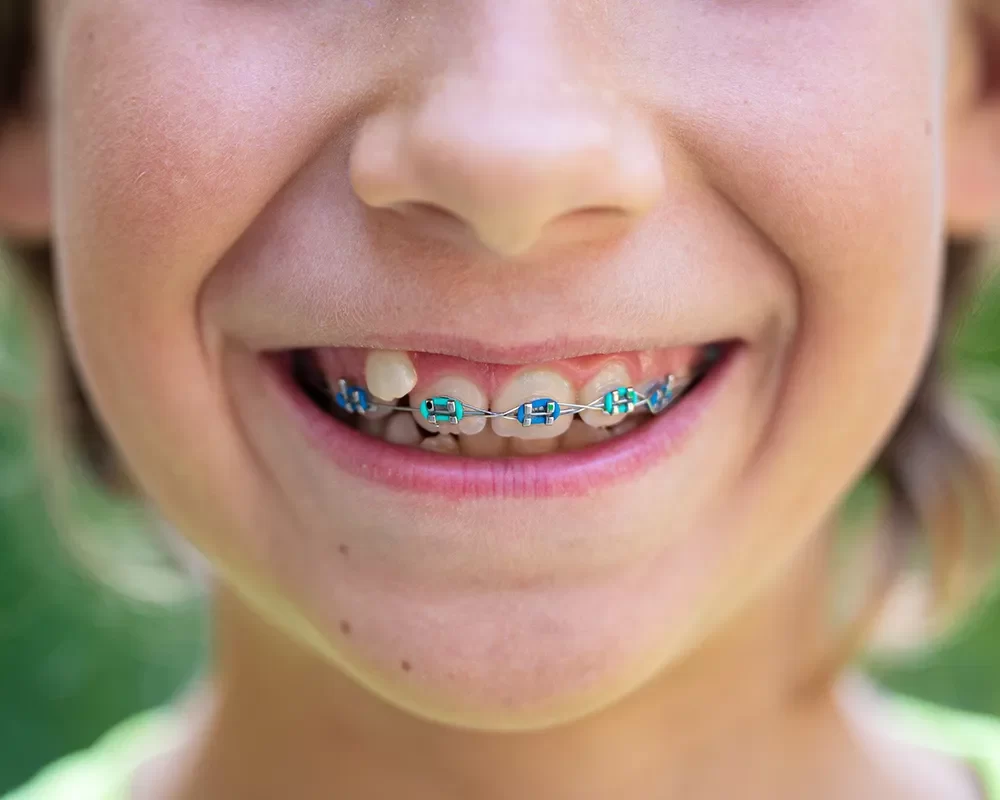 Perfect Orthodontics in St. Clair, Toronto