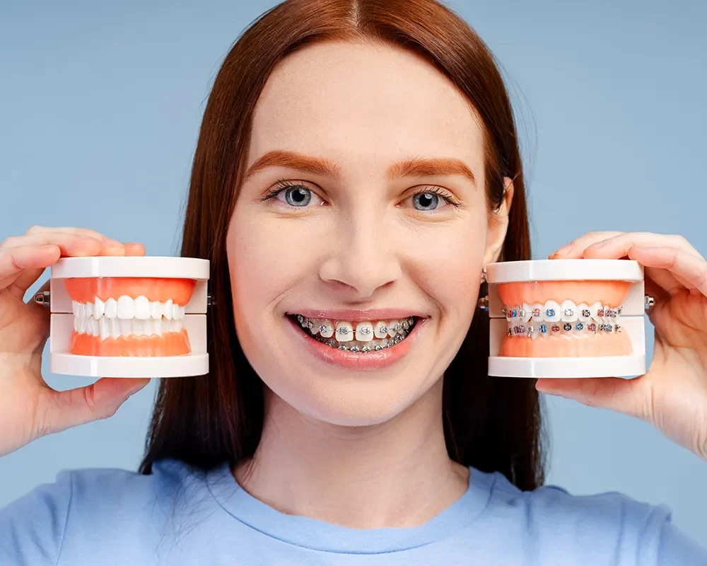 Affordable Orthodontics in St. Clair, Toronto
