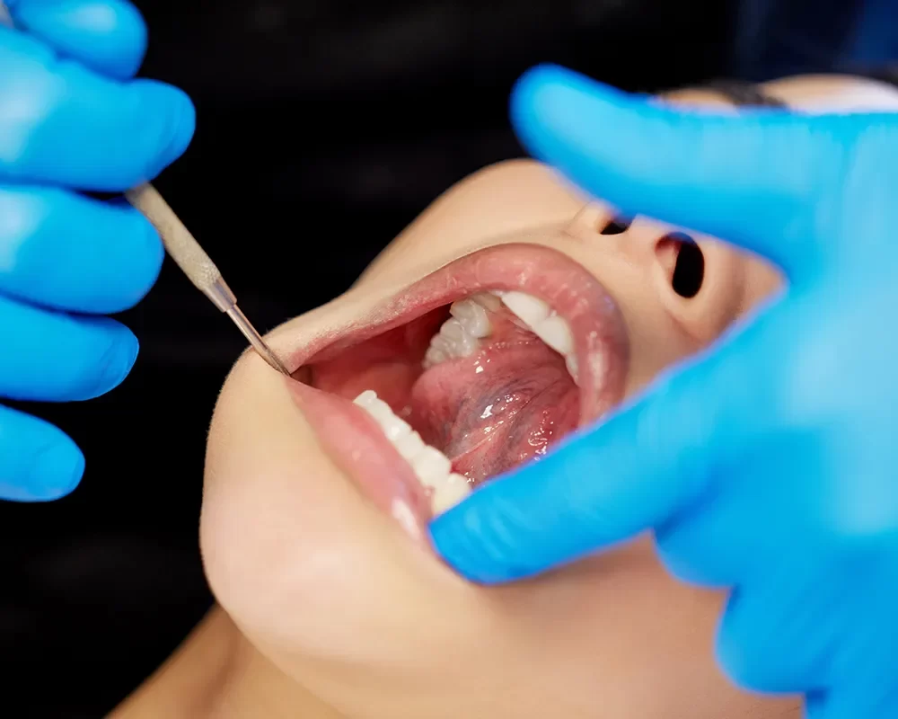 Preventive Dentistry in Toronto