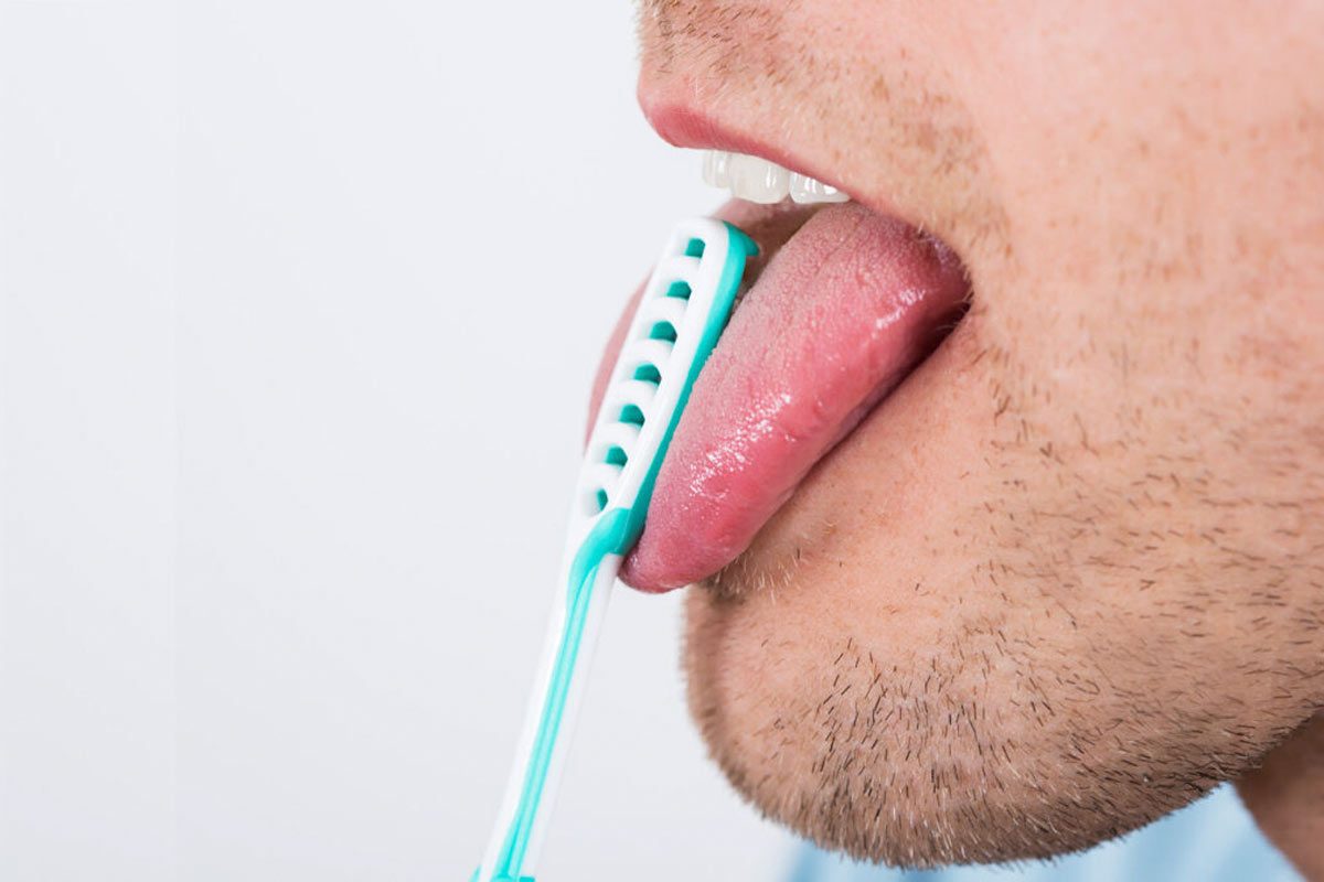 Tongue Scraping The Benefits of Tongue Scraping By Smile Dental in Toronto