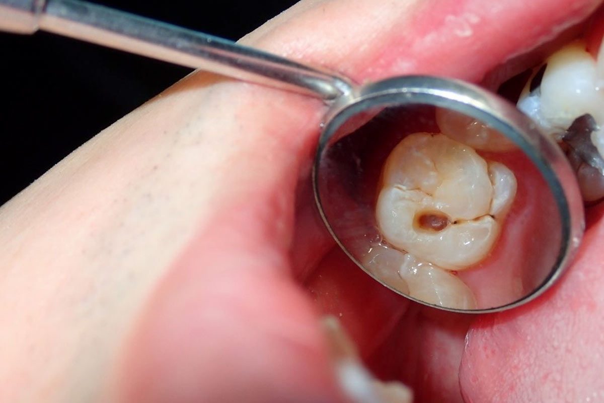 Dental Exam The Impact of Sleep Disorders on Oral Health