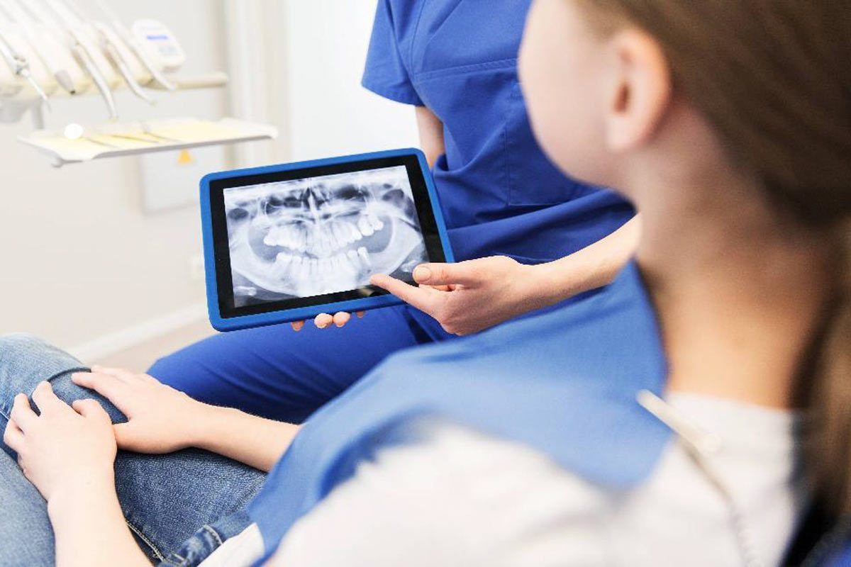 Dental X-Rays The Importance of Dental X-Rays