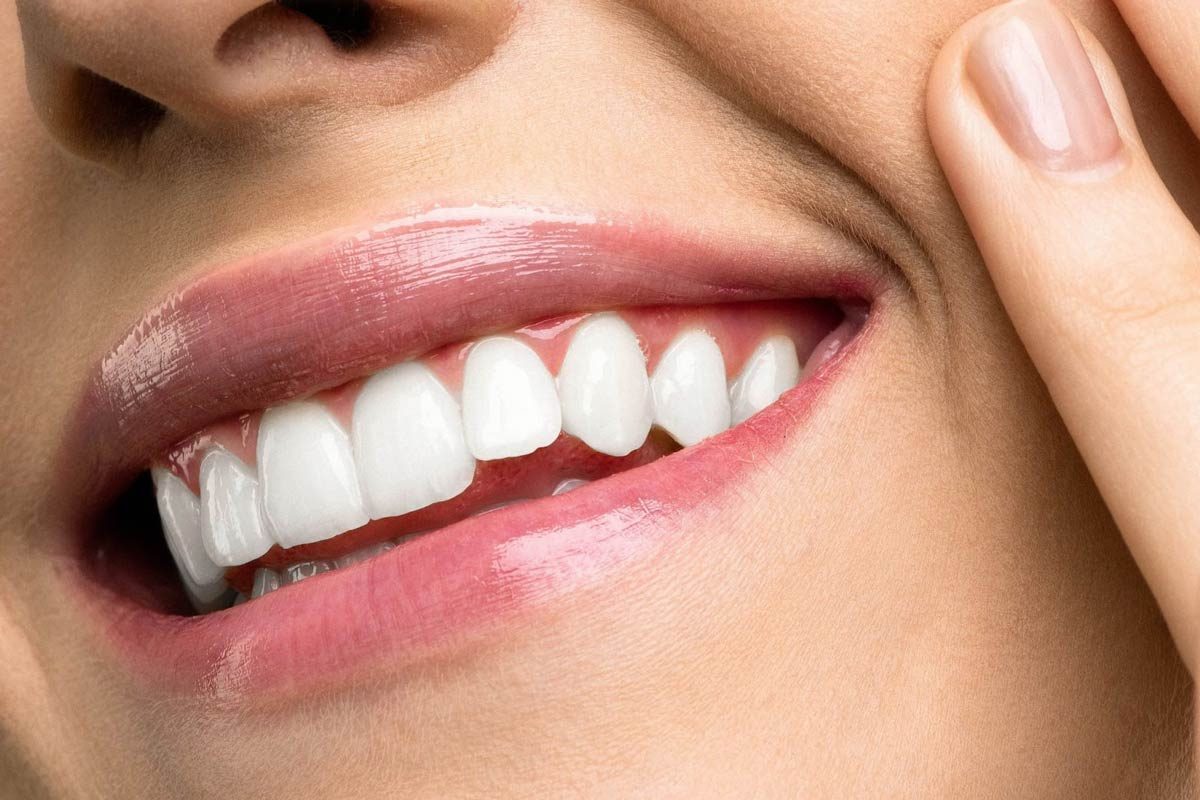 Teeth Whitening A Guide to a Dazzling, Safe Smile with Teeth Whitening