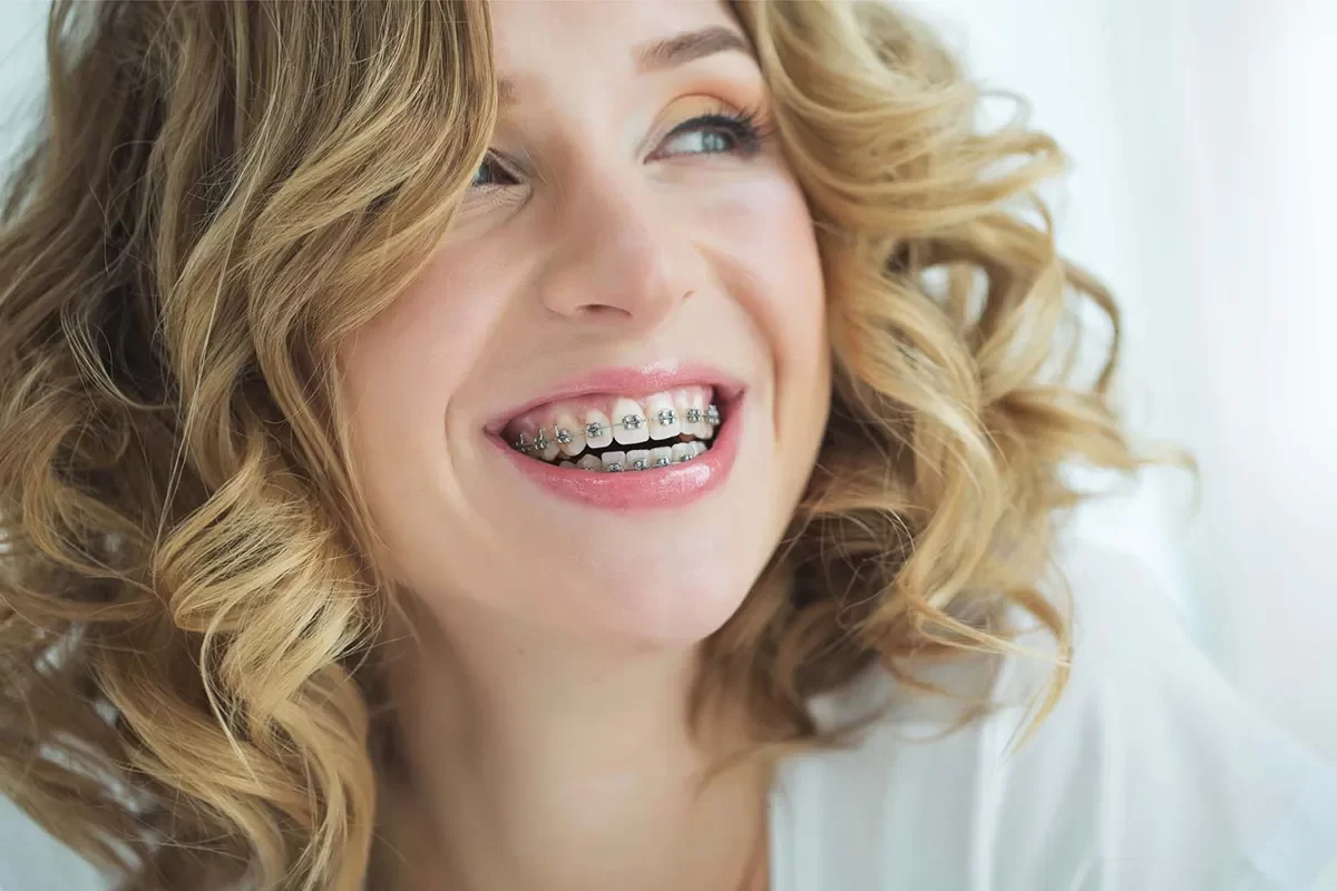 The Benefits of Orthodontic Treatments