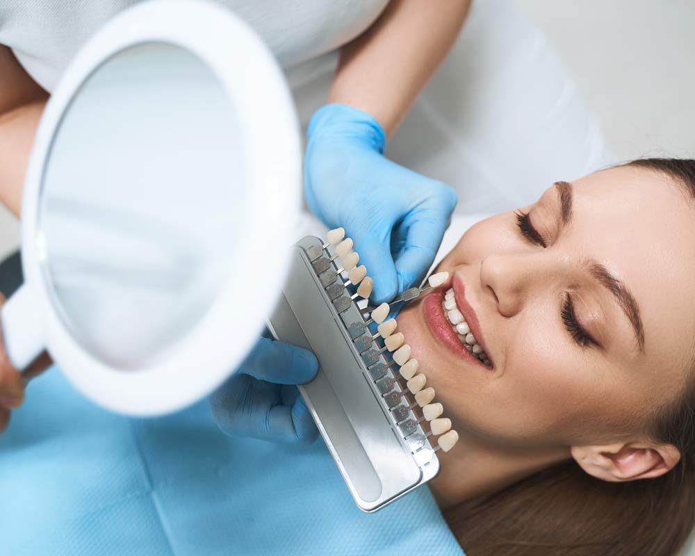 Affordable Dental Veneers in St. Clair, Toronto