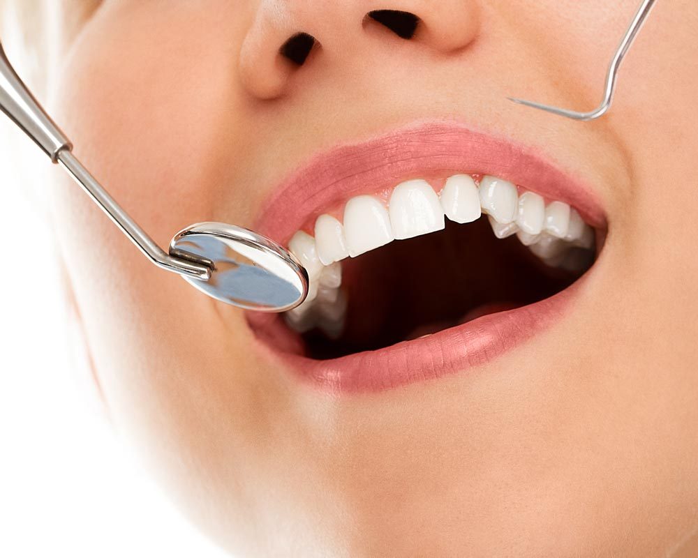 Affordable Tooth Extraction in Toronto
