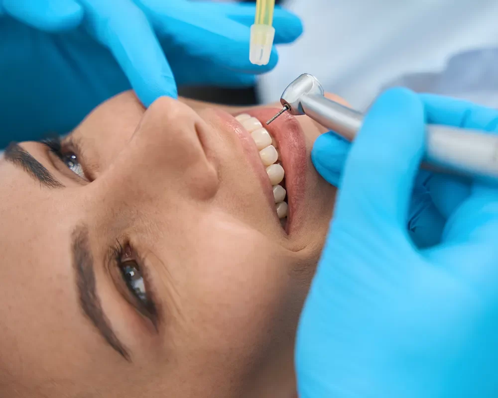 Root Canal Therapy in Toronto