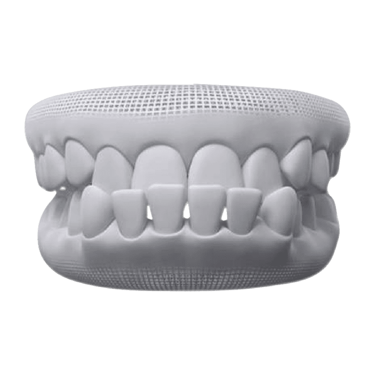 Underbite-768×768 Underbite-768x768
