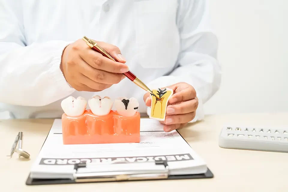Success Rate of Dental Implants