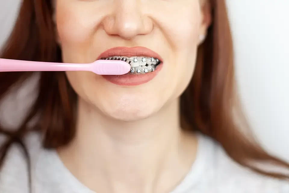 The Best Oral Hygiene in Richmond Hill, Toronto