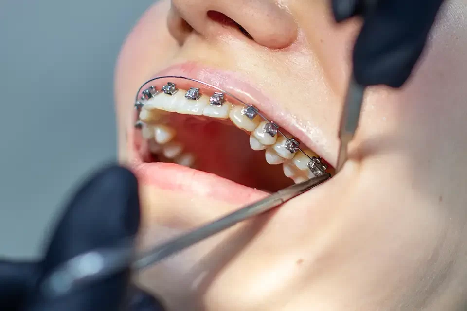 a-woman-at-a-dentist-s-appointment Risks and Complications of Orthodontics