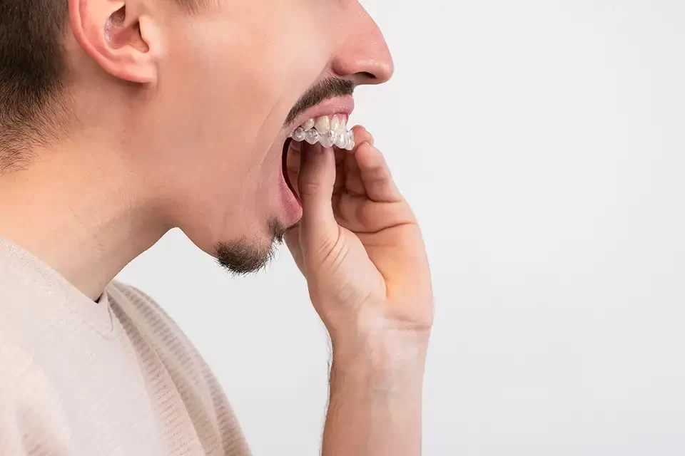 Benefits of a Night Guard for Teeth Grinding