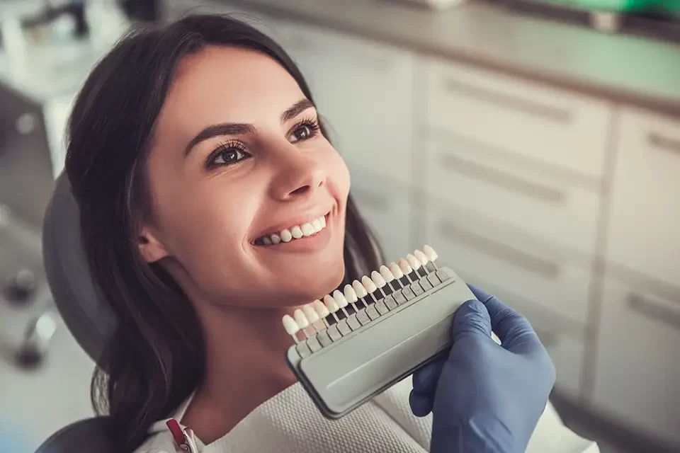 Can You Whiten Dental Veneers?