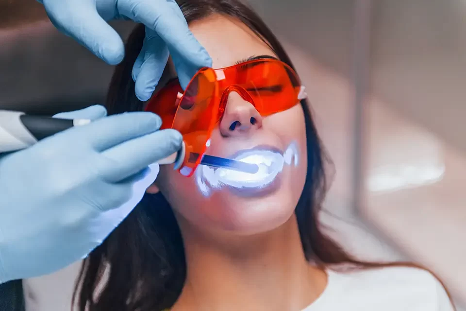 Best Teeth Whitening in Richmond Hill, Toronto