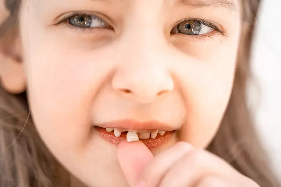 How to Prevent Cavities in Baby Teeth