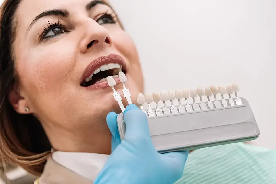 Porcelain Veneers vs Composite Veneers: Key Differences