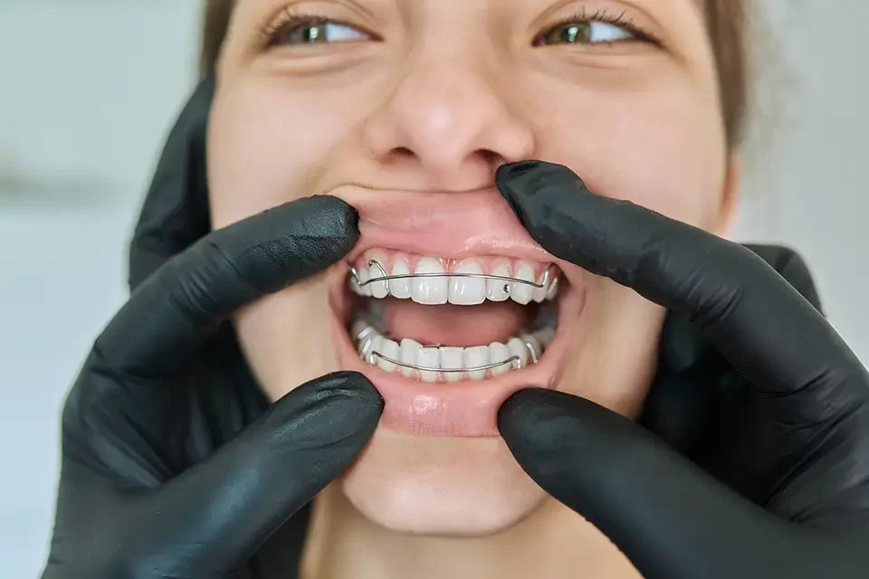 Addressing Common Orthodontic Issues And Their Solutions