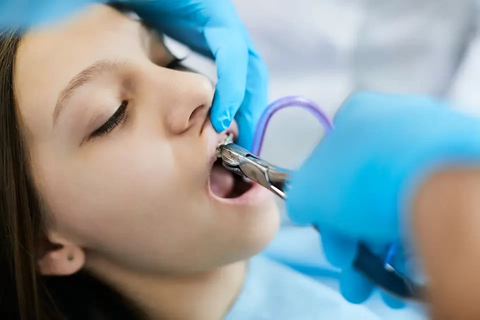 Tooth Extraction and Orthodontics