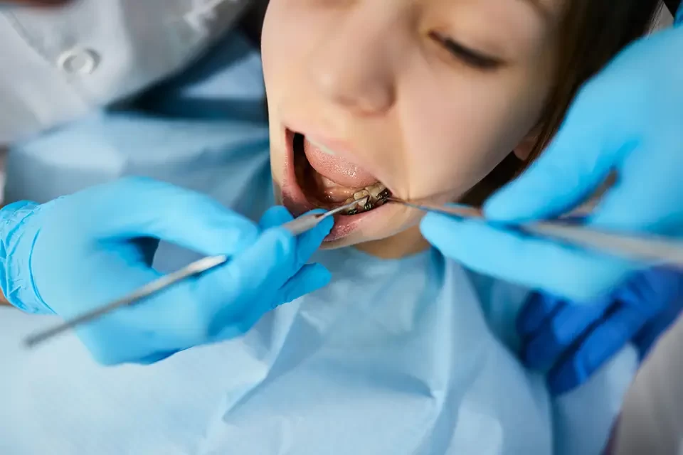 The Oral Surgery for Wisdom Teeth Extraction Procedure