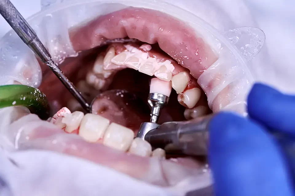 How We Sized Up Dental Clinics Near Rockcliffe-Smythe (Fast Checklist)